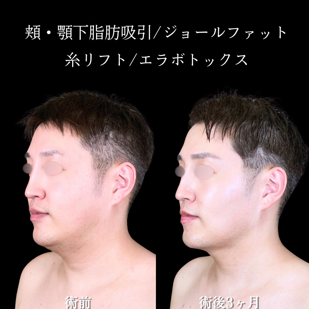 No.16546の症例写真2